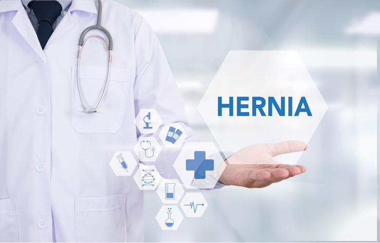Hérnia incisional