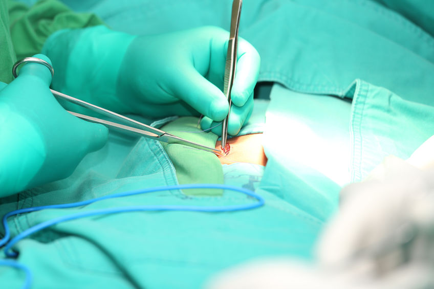 cirurgia de hérnia epigástrica