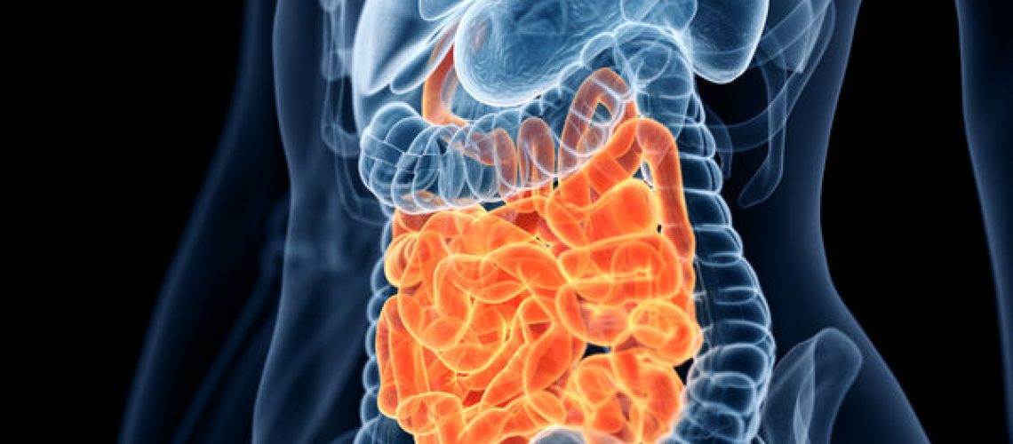 obstrução intestinal