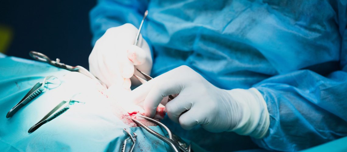 Cirurgia De Hérnia
