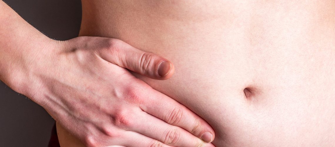 hernia